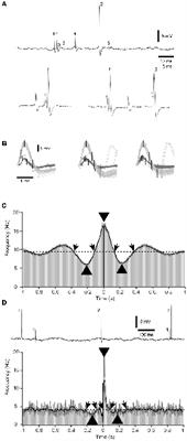 Absence of Repetitive Correlation Patterns Between Pairs of Adjacent Neocortical Neurons in vivo